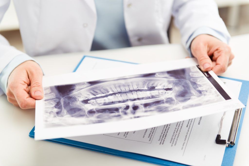 Radiologia dental- BF Estetica Dental - Centro odontológico - Ortodoncia