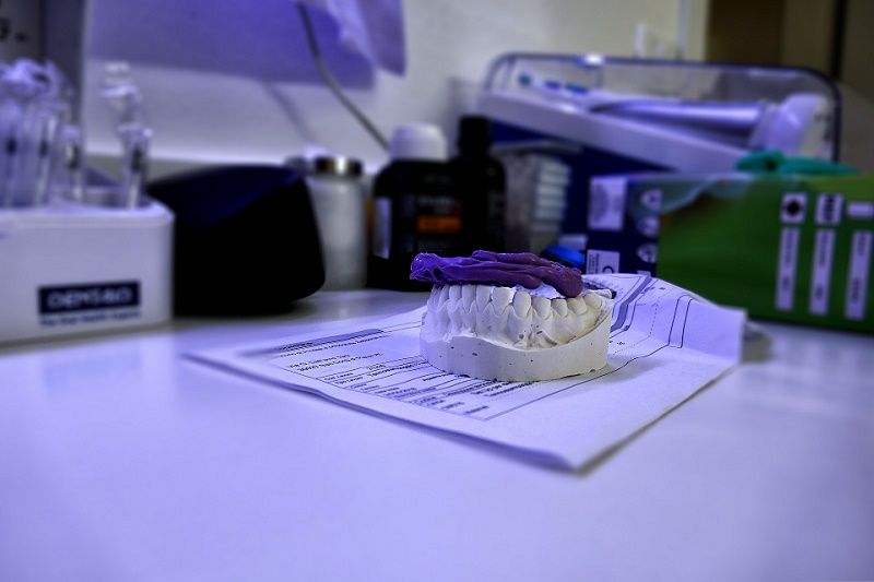 Prognatismo mandibular - Cirugía maxilofacial - BF Estética Dental Prognatismo mandibular - Cirugía maxilofacial - BF Estética Dental
