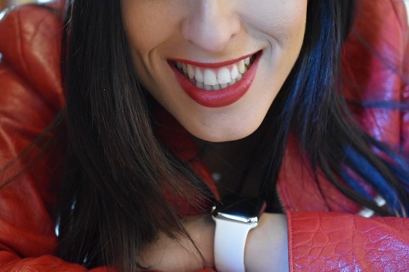 Estética dental - Carillas - BF Estética Dental