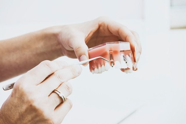 Edentulismo - odontología - BFEstéticaDental