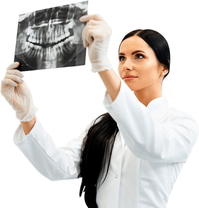 Diente retenido - BFEsteticaDental - Exodoncia