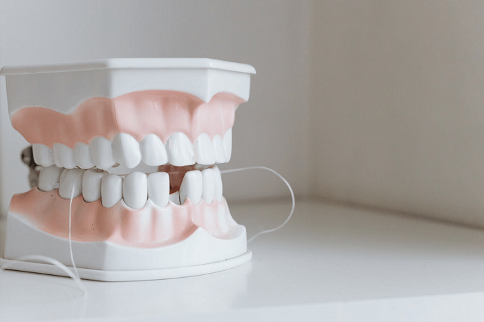 perdida de un diente 1 - pieza dental - BFEstéticaDental