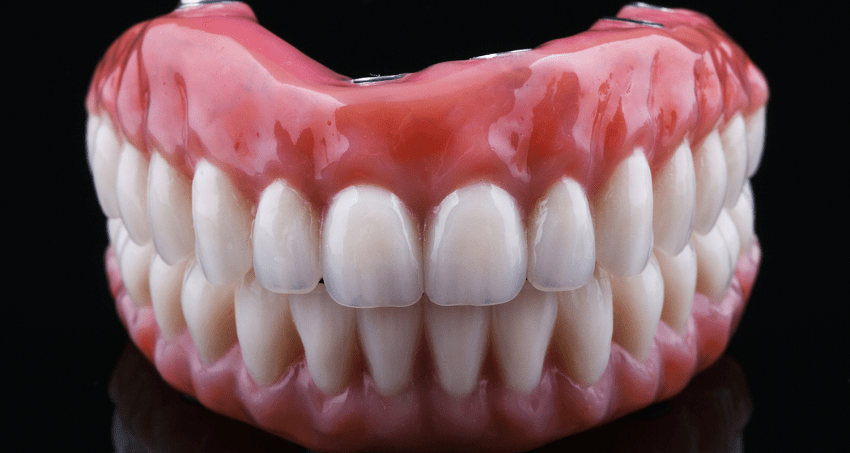 Inteligencia artificial - prótesis dental - BFEstéticaDental