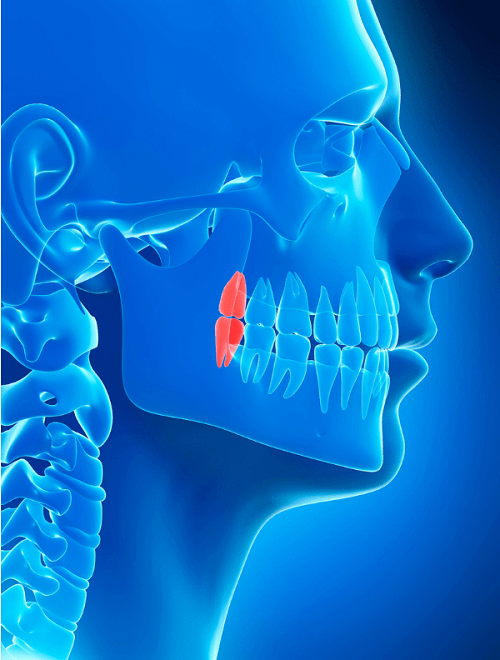 Cordales - Recomendaciones quirúrgicas - BFEstéticaDental