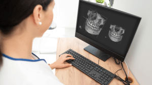 Innovaciones tecnológicas - Escaneo 3D - BFEstéticaDental