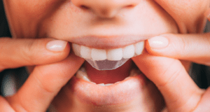 Tiras blanqueadoras - en casa - BFEstéticaDental