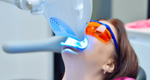 Tratamientos de Blanqueamiento dental - LED - BFEstéticaDental