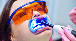 blanqueamiento dental - Tratamiento Láser - BFEstéticaDental