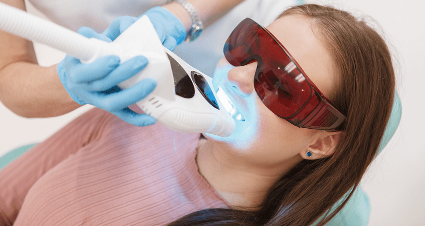 blanqueamiento dental - tratamientos LED y Láser - BFEstéticaDental