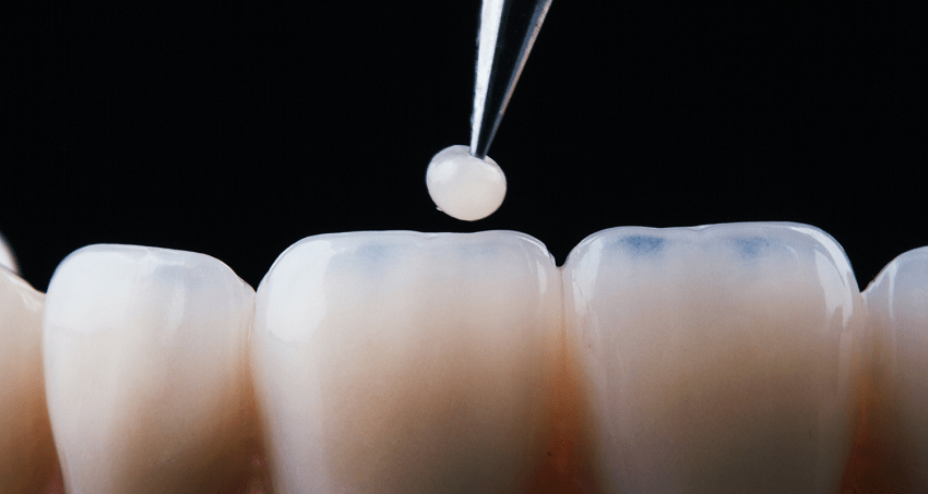 Odontología biomimética - Estética - BFEstéticaDental