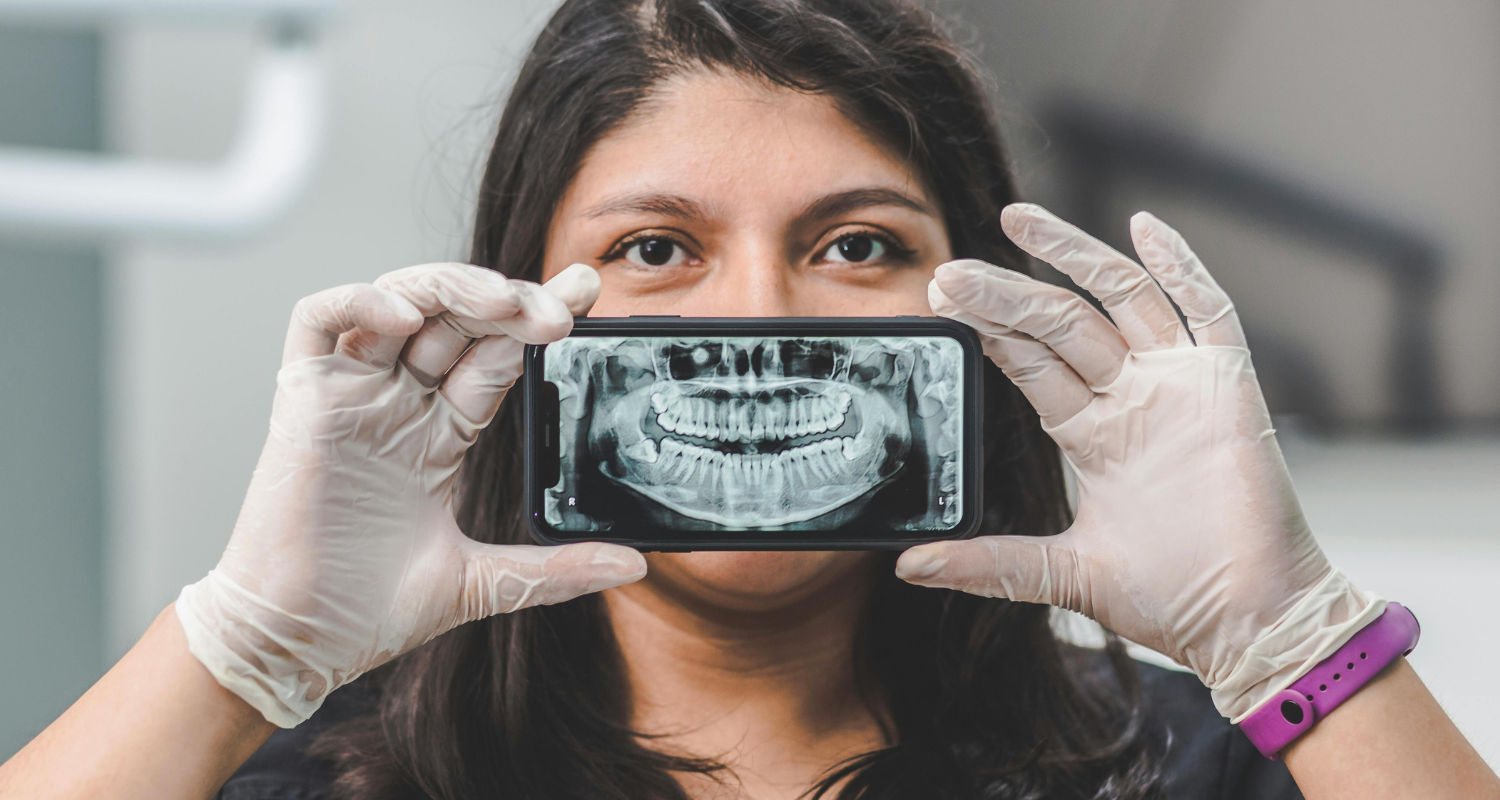 Relevancia clínica - Nervio mandibular - BFEstéticaDental