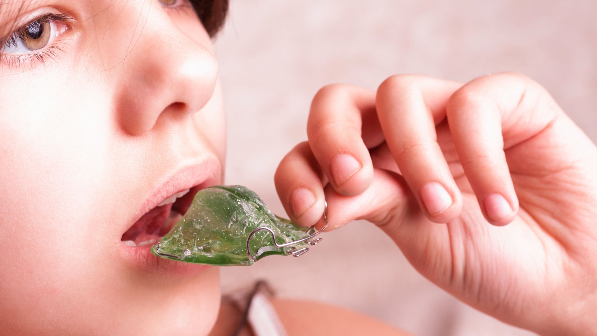 Aparatología Utilizada - Ortodoncia intercpetiva - BFEstéticaDental