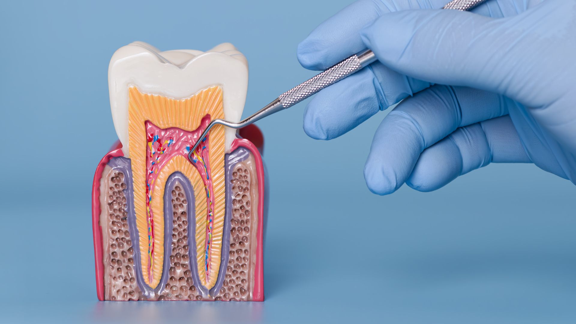 Cómo Saber si Necesitas Periodoncia Avanzada - BFEstéticaDental