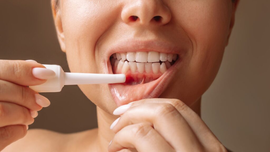 Periodoncia Avanzada - Salud de las encías - 1 BF Estética Dental